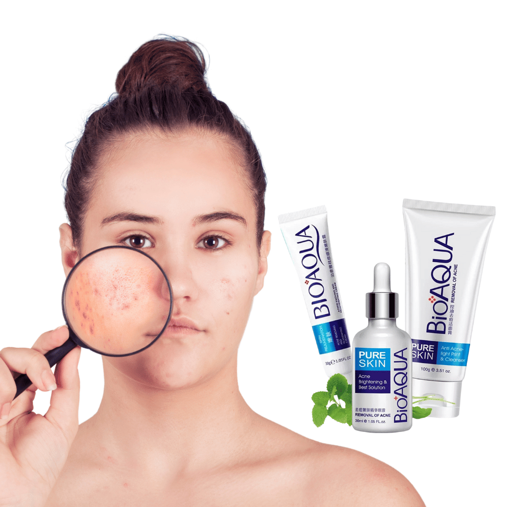 💗✨ Kit Antiacné (x3) – BIOAQUA